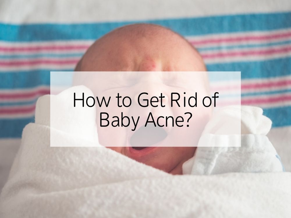 How to Get Rid of Baby Acne?
