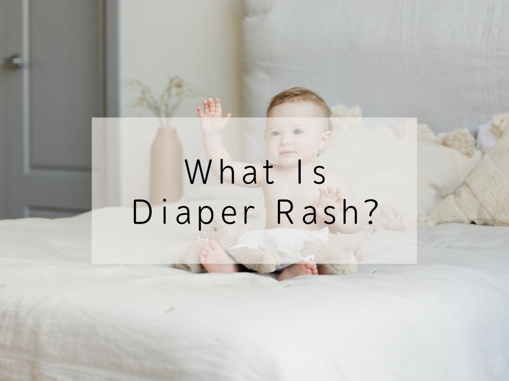 What Is Diaper Rash?